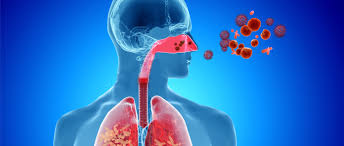 Tratamiento para Enfermedades Respiratorias